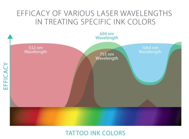 Infographic showing tattoo removal machines wavelengths
